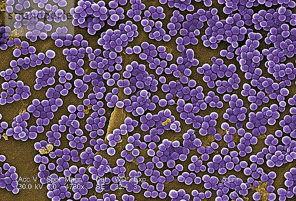 Diese eingefärbte Rasterelektronenmikroskop-Aufnahme (REM) zeigt zahlreiche Klumpen von Methicillin-resistenten Staphylococcus aureus-Bakterien  die gemeinhin mit dem Akronym MRSA bezeichnet werden; Vergrößerung 4780x. Kürzlich erkannte Ausbrüche oder Cluster von MRSA in Gemeinschaftseinrichtungen wurden mit Stämmen in Verbindung gebracht  die im Vergleich zu den herkömmlichen MRSA-Stämmen in Krankenhäusern einige einzigartige mikrobiologische und genetische Eigenschaften aufweisen  was darauf schließen lässt  dass einige biologische Eigenschaften  z. B. Virulenzfaktoren wie Toxine  es den Gemeinschaftsstämmen ermöglichen  sich leichter zu verbreiten oder mehr Hautkrankheiten zu verursachen.