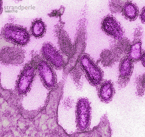 Diese kolorierte Transmissionselektronenmikroskopie (TEM) einer ultradünnen Probe zeigt einige der ultrastrukturellen morphologischen Merkmale  die in den Virionen des Influenzavirus von 1918 zu finden sind. Die auffälligen Oberflächenvorsprünge auf den Virionen bestehen entweder aus Glykoproteinen des Hämagglutinin- oder des Neuraminidase-Typs. Die dichte Hülle  die wie Punkte oder Röhrchen aussieht  wird als Kapsid bezeichnet und umgibt die Nukleinsäurebestandteile der Virionen.