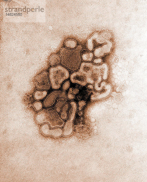 Diese kolorierte Transmissions-Elektronenmikroskopie (TEM) mit 37.800-facher Vergrößerung zeigt einen Stamm der Schweinegrippe  das A/New Jersey/76 (Hsw1N1)-Virus  während der ersten Entwicklungsphase des Virus in einem Hühnerei. Die Schweinegrippe (Schweinegrippe) ist eine Atemwegserkrankung bei Schweinen  die durch Influenzaviren vom Typ A verursacht wird  die regelmäßig Ausbrüche der Grippe bei Schweinen verursachen. Schweinegrippeviren verursachen hohe Krankheits- und niedrige Sterberaten bei Schweinen. Schweinegrippeviren können bei Schweinen das ganze Jahr über zirkulieren  die meisten Ausbrüche in Schweinebeständen treten jedoch ähnlich wie beim Menschen in den späten Herbst- und Wintermonaten auf. Das klassische Schweinegrippevirus (ein Influenzavirus vom Typ A H1N1) wurde erstmals 1930 von einem Schwein isoliert.