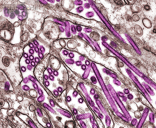 Koloriertes Transmissionselektronenmikroskopbild von Vogelgrippe-A-H5N1-Viren  die in MDCK-Zellen gezüchtet wurden. Vogelgrippe-A-Viren infizieren den Menschen normalerweise nicht; seit 1997 wurden jedoch mehrere Fälle von Infektionen und Ausbrüchen beim Menschen gemeldet. Wenn solche Infektionen auftreten  werden diese Situationen von den Gesundheitsbehörden genau überwacht.
