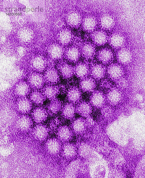 Diese kolorierte Transmissions-Elektronenmikroskopie (TEM) zeigt einen Teil der ultrastrukturellen Morphologie von Norovirus-Viren bzw. Viruspartikeln.