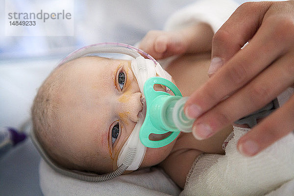 Reportage aus der Neonatologie der Stufe 2 in einem Krankenhaus in Haute-Savoie  Frankreich. Eine Krankenschwester beruhigt ein Neugeborenes  das nach dem Einatmen von Fruchtwasser unter Atemnot leidet.