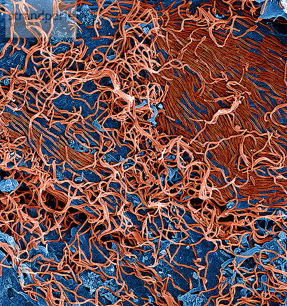 Kolorierte rasterelektronenmikroskopische Aufnahme von fadenförmigen Ebola-Viruspartikeln (rot)  die sich an eine chronisch infizierte VERO E6-Zelle (blau) anlagern und aus ihr herauswachsen (25.000fache Vergrößerung).