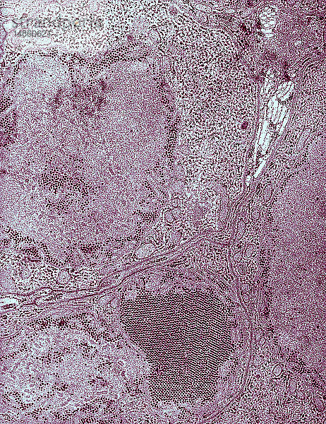 SAINT-LOUIS-ENZEPHALITIS-VIRUS