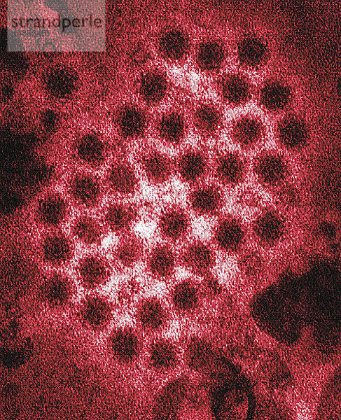Diese kolorierte Transmissions-Elektronenmikroskopie (TEM) zeigt einen Teil der ultrastrukturellen Morphologie von Norovirus-Viren bzw. Viruspartikeln.
