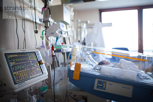 Reportage aus der Neonatologie der Stufe 2 in einem Krankenhaus in Haute-Savoie  Frankreich. Ein Neugeborenes mit Atembeschwerden  das Fruchtwasser eingeatmet hat.