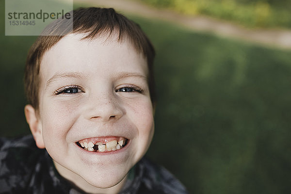 Bildnis eines Jungen mit Sommersprossen und schiefen Zähnen