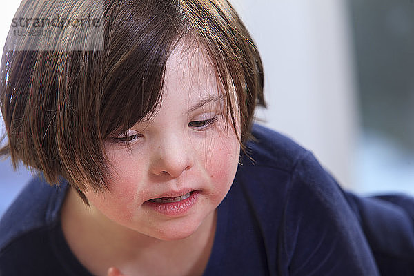 Kleines Mädchen mit Down-Syndrom