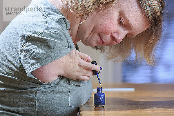 Frau mit TAR-Syndrom lackiert ihre Nägel zu Hause
