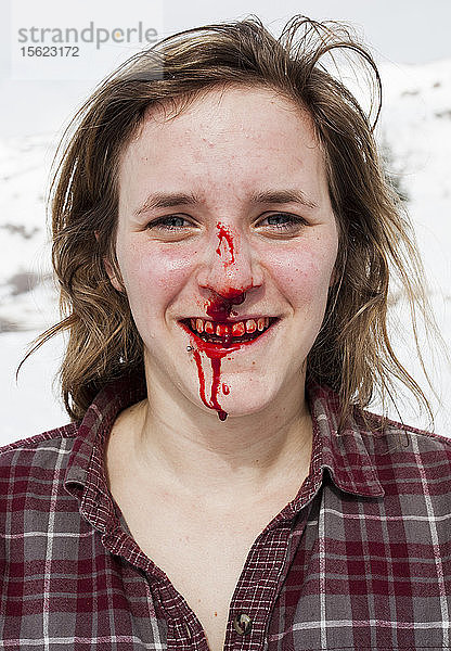Ein Mädchen mit einer blutigen gebrochenen Nase lächelt trotz der Schmerzen  nachdem sie mit ihrem Snowboard gestürzt ist.