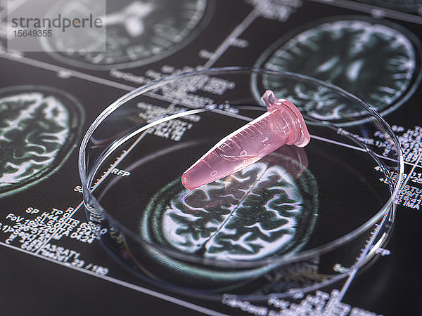 Klinische Proben aus einem Forschungsprojekt  die in Fläschchen mit Hirnscan-Bildern enthalten sind  Forschung über Alzheimer und demenzielle Erkrankungen.