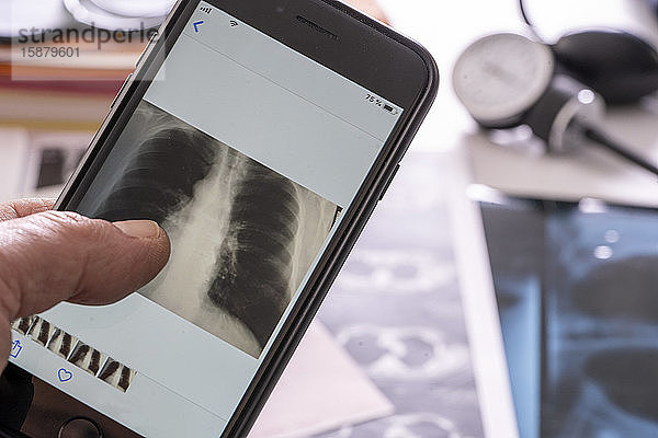 Hand einer Person  die ein Röntgenbild auf einem Smartphone überprüft