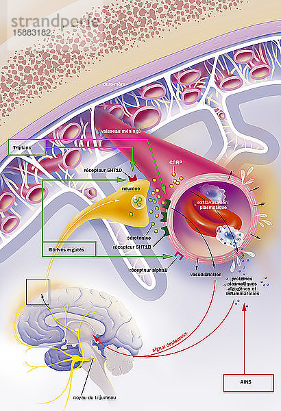 Der Migräneanfall und seine Behandlung. Oben ein Schnitt durch den Schädel  der von den Hirnhäuten ausgekleidet ist (Dura mater  Arachnoidea  die mit der Pia mater durch Spangen verbunden ist  Pia mater  Membrangefäß  das das Gehirn direkt bedeckt). eines der Hirnhautgefäße ist vergrößert. Unten ein Schnitt des Gehirns mit dem Kern des Nervus trigeminus (gelb)  der von oben nach unten den Nervus ophthalmicus  den Nervus maxillaris  den Nervus mandibularis ergibt. Letzterer gibt einen meningealen Ast (gelber Zoom) ab  dessen synaptischer Kontakt mit den 5HT1B-Rezeptoren (dunkelgrün) des meningealen Gefäßes zu sehen ist. Die Krise wird durch die Aktivierung des trigemino-vaskulären Systems (Gehirn und Neuron des Meningealastes) verursacht  die einerseits die Freisetzung von gefäßerweiternden Peptiden (Serotonin (grüne Kügelchen) und CGRP (rot-orange Kügelchen)) und andererseits Plasmalextravasation und Entzündung hervorruft. Auf dem Neuron zielt ein 5HT1D-Rezeptor (rot) auf Mutterkornderivate sowie der Alpha-1-Rezeptor (rosa) auf das Gefäß.