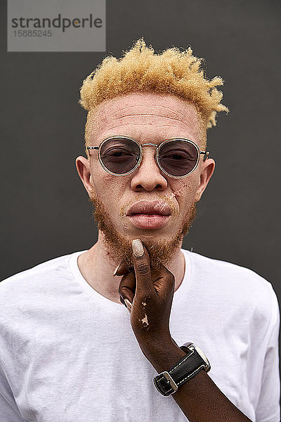 Porträt eines Albino-Mannes  der von Frauenhand berührt wird
