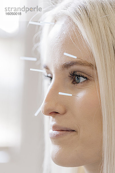 Akupunktur  junge Frau mit Akupunkturnadel bei Behandlung im Gesicht
