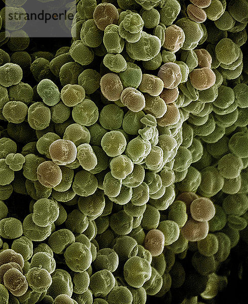 Mikroskopische Ansicht von Pollenkörnern
