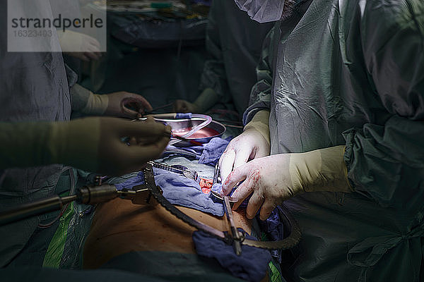 Chirurgen bei der Transplantation einer Niere