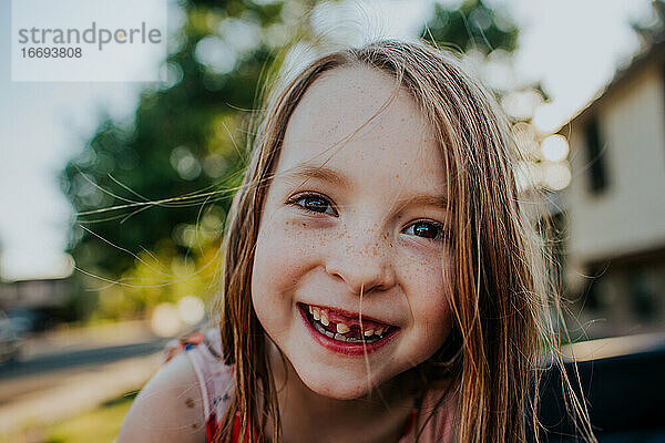 Glückliches junges Mädchen lächelt und zeigt einen fehlenden Zahn