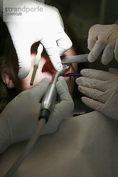 Close up Frau erhalten Zahnreinigung in Zahnarztpraxis