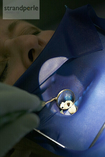 Close up Zahnarzt untersucht zahnärztliche Füllung des Patienten mit Spiegel