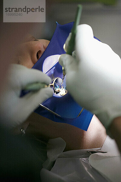 Close up Zahnarzt Reinigung Zähne der Frau