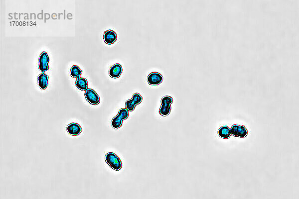 Streptococcus agalactiae-Bakterien  verantwortlich für Vaginal- und Harnwegsinfektionen sowie Infektionen bei Neugeborenen  einschließlich Meningitis und Septikämie. Optisch mikroskopische Ansicht.