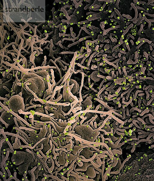 Kolorierte rasterelektronenmikroskopische Aufnahme einer VERO E6-Zelle (hellbraun) mit verlängerten Zellfortsätzen und Anzeichen von Apoptose nach Infektion mit SARS-COV-2-Viruspartikeln (grün)  die aus einer Patientenprobe isoliert wurden. Das Bild wurde in der NIAID Integrated Research Facility (IRF) in Fort Detrick  Maryland  aufgenommen. Bildnachweis: NIAID.