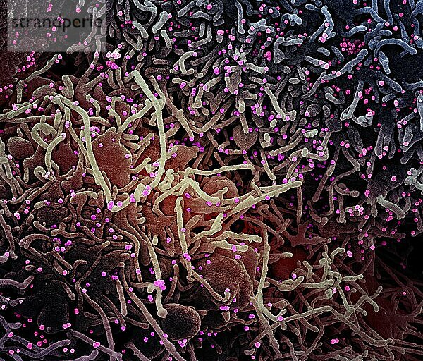 Kolorierte rasterelektronenmikroskopische Aufnahme einer VERO E6-Zelle (violett) mit verlängerten Zellfortsätzen und Anzeichen von Apoptose nach Infektion mit SARS-COV-2-Viruspartikeln (rosa)  die aus einer Patientenprobe isoliert wurden. Das Bild wurde in der NIAID Integrated Research Facility (IRF) in Fort Detrick  Maryland  aufgenommen. Bildnachweis: NIAID.
