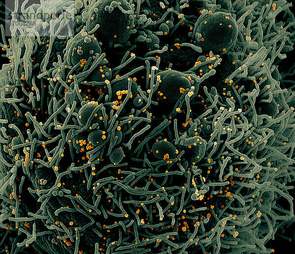 Koloriertes Rasterelektronenmikroskopbild einer apoptotischen Zelle (grün)  die mit SARS-COV-2-Viruspartikeln (orange) infiziert ist und aus einer Patientenprobe isoliert wurde. Das Bild wurde in der NIAID Integrated Research Facility (IRF) in Fort Detrick  Maryland  aufgenommen. Bildnachweis: NIAID.