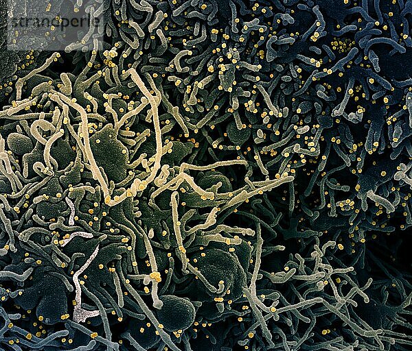 Kolorierte rasterelektronenmikroskopische Aufnahme einer VERO E6-Zelle (blau-grün) mit verlängerten Zellfortsätzen und Anzeichen von Apoptose nach Infektion mit SARS-COV-2-Viruspartikeln (gelb)  die aus einer Patientenprobe isoliert wurden. Das Bild wurde in der NIAID Integrated Research Facility (IRF) in Fort Detrick  Maryland  aufgenommen. Bildnachweis: NIAID.