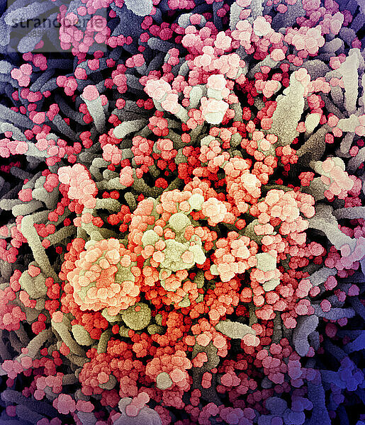Koloriertes Rasterelektronenmikroskopbild einer stark mit SARS-CoV-2-Viruspartikeln (orange/rot) infizierten Zelle  isoliert aus einer Patientenprobe. Das Bild wurde in der NIAID Integrated Research Facility (IRF) in Fort Detrick  Maryland  aufgenommen. Bildnachweis: NIAID.