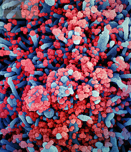 Koloriertes Rasterelektronenmikroskopbild einer Zelle (blau)  die stark mit SARS-CoV-2-Viruspartikeln (rot) infiziert ist und aus einer Patientenprobe isoliert wurde. Das Bild wurde in der NIAID Integrated Research Facility (IRF) in Fort Detrick  Maryland  aufgenommen. Bildnachweis: NIAID.