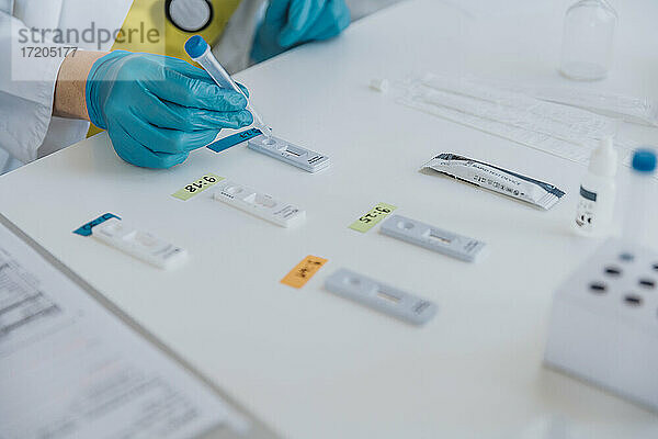 Fachwissen über das Einlegen von Proben in Testkassetten bei der Arbeit im Untersuchungsraum