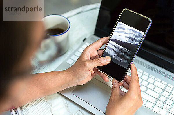 Frau betrachtet ihr Röntgenbild auf dem Mobiltelefon zu Hause  Konzept des virtuellen Arztes.