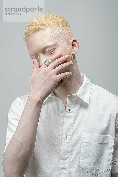 Studio-Porträt eines Albino-Mannes im weißen Hemd