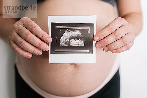 Schwangere Frau hält einen Ultraschall ihres Babys.