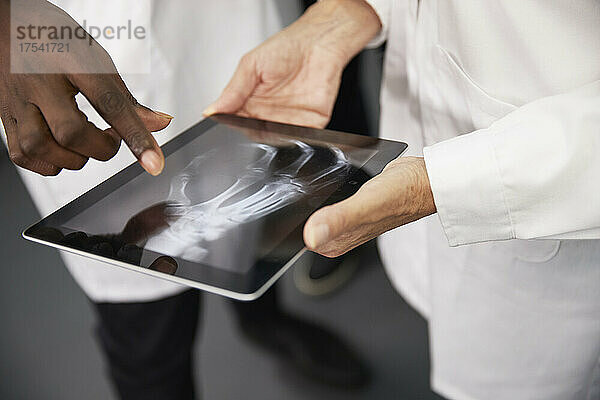 Arzt und Kollege halten Tablet-PC mit Röntgenbild im Krankenhaus