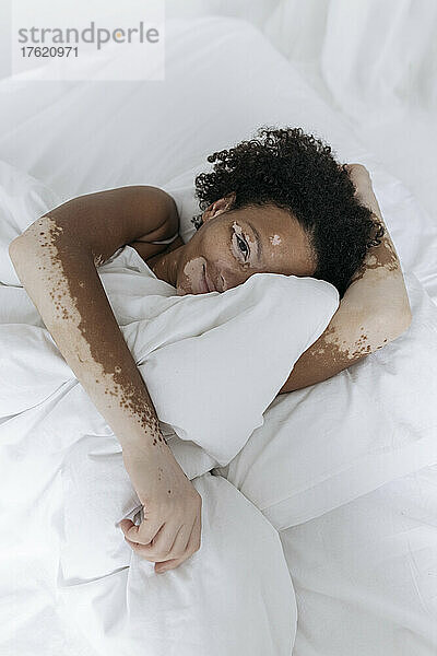 Smiling woman with vitiligo covering face with blanket on bed at home