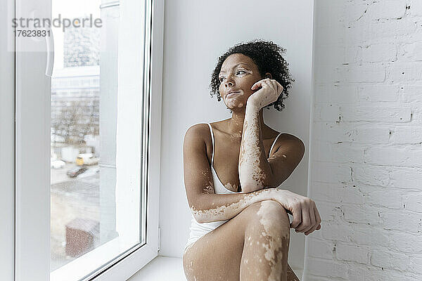Frau mit Vitiligo schaut zu Hause durch Glasfenster