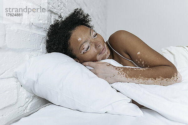 Frau mit Vitiligo schläft zu Hause im Bett