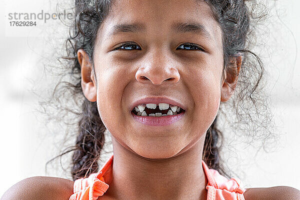 Nahaufnahme des Mädchenmundes mit schiefen gebrochenen Zähnen und Odontolith