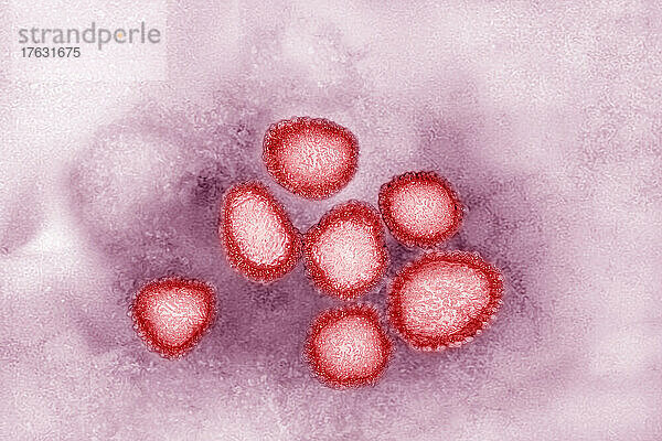 Coronavirus (CoV). Viren der Familie Coronaviridae und der Unterfamilie Orthocoronavirinae. Es ist ein Erreger respiratorischer Syndrome. Aus einem Transmissionselektronenmikroskop-Bild (TEM) betrachtet. Virusdurchmesser 80 nm bis 100 nm.