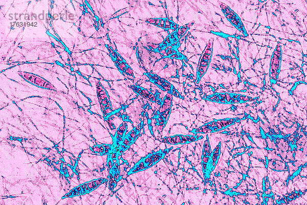 Microsporum canis ist eine Pilzart der Gattung Microsporum  die für die meisten Fälle von Ringelflechte bei Hunden und Katzen sowie beim Menschen verantwortlich ist. X 1000 optische Mikroskopie.