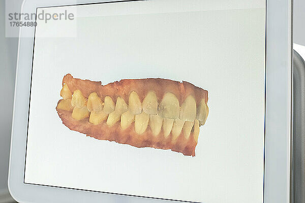 Gescanntes Bild der Zähne auf dem Bildschirm einer Zahnklinik