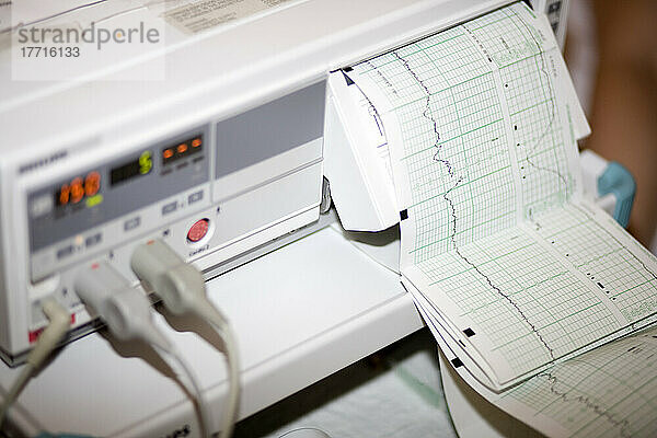 Nahaufnahme einer EKG-Maschine in einem Krankenhaus