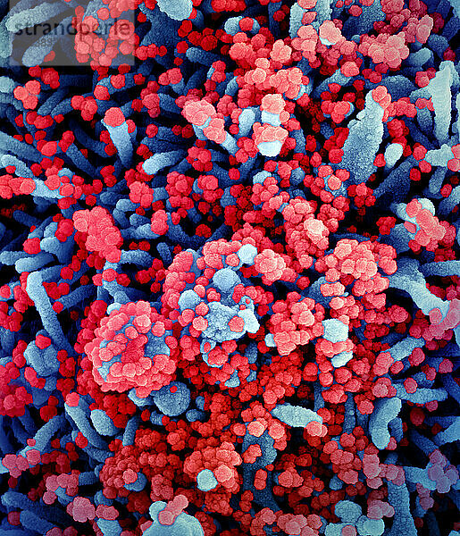 Kolorierte Rasterelektronenmikroskopaufnahme einer Zelle (blau)  die stark mit SARS-CoV-2-Viruspartikeln (rot) infiziert ist und aus einer Patientenprobe isoliert wurde. Bild angefordert von der NIAID Integrated Research Facility (IRF) in Fort Detrick  Maryland.
