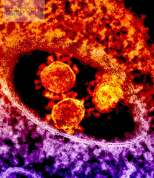 Die runden  spitzen Objekte in der Bildmitte sind Partikel des MERS-Coronavirus.