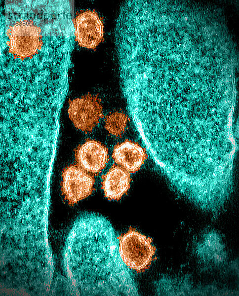 Dieses Transmissionselektronenmikroskopbild zeigt SARS-CoV-2  auch bekannt als 2019-nCoV  das Virus  das COVID-19 verursacht. Aus der Oberfläche einer im Labor kultivierten Zelle treten Viruspartikel aus. Spitzen am äußeren Rand von Viruspartikeln geben Coronaviren ihren Namen und ähneln einer Krone. Das Bild wurde in den Rocky Mountain Laboratories in Hamilton  Montana  aufgenommen und koloriert. Bildnachweis: NIAID