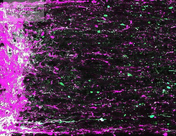 Eine vom NIH finanzierte Mausstudie ist die erste  die zeigt  dass visuelle Stimulation dazu beiträgt  das visuelle System neu zu verdrahten und das Sehvermögen teilweise wiederherzustellen. Dieses Bild zeigt die Regeneration der Axone retinaler Ganglienzellen der Maus (magenta und grün)  die sich von der Stelle der Sehnervenverletzung aus erstrecken (links).