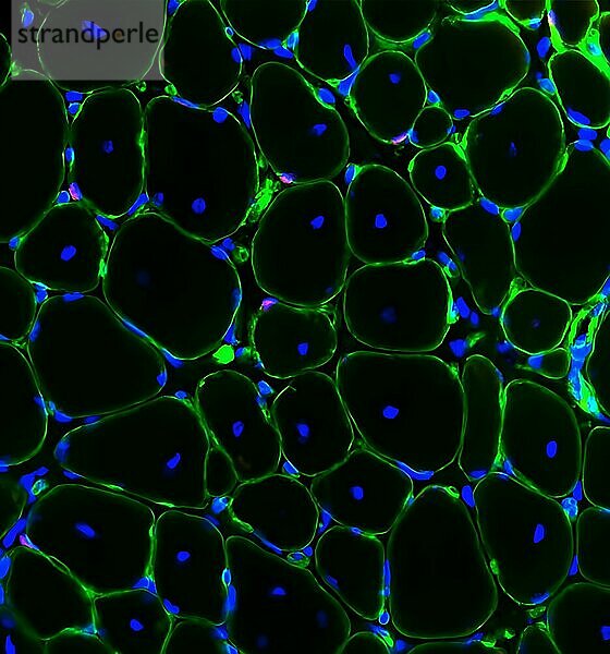 Dieser Querschnitt eines regenerierten Muskels zeigt Muskelstammzellen (rot) in ihrer Nische entlang der Muskelfasern (grün). Die blauen Punkte sind die DNA in den Faserkernen. Forscher haben herausgefunden  dass die Injektion des Moleküls Prostaglandin E2 in Muskeln nach einer Verletzung die Teilung von Muskelstammzellen anregt und die Regeneration beschleunigt. Prostaglandin E2 ist ein entzündliches Molekül  das als Reaktion auf Muskelverletzungen oder harte körperliche Betätigung freigesetzt wird.